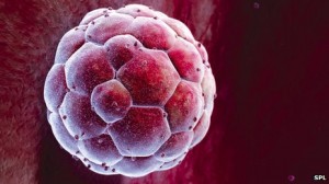 _67619413_p6800679-human_blastocyst-spl[1]